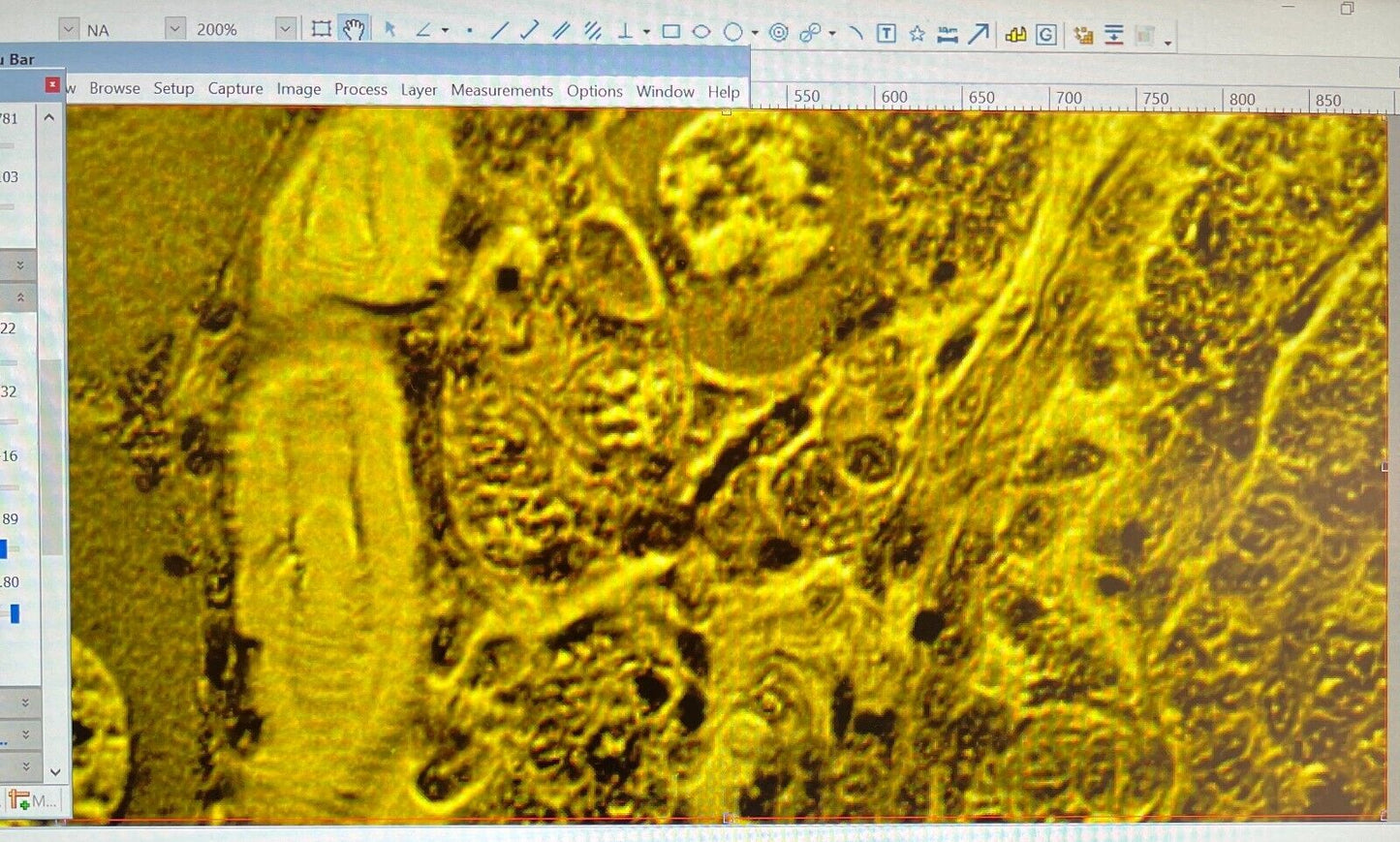 Leica DMR E Nomarski DIC Fluoresence Phase Contrast Microscope + 10MP Camera